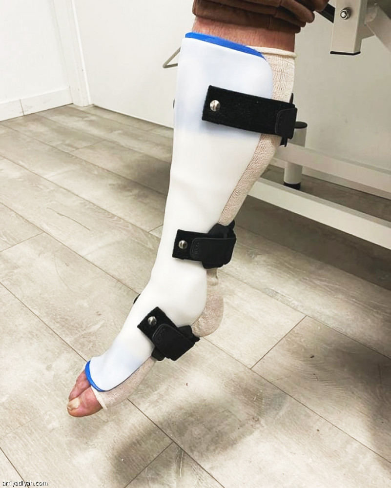 الرائد
يخسر هيريرين