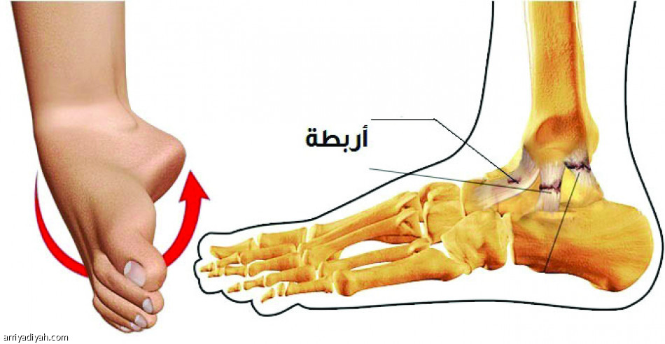 إصابة المفصل الأكثر شيوعا عند الرياضيين